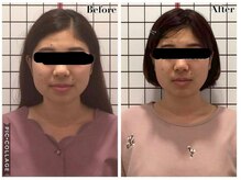 堺整骨院 小郡院/小顔矯正