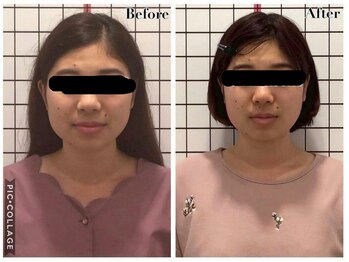 堺整骨院 小郡院/小顔矯正