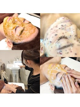 ハリツヤをUPしたい