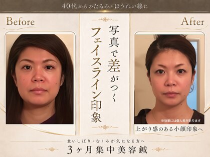 ピュアハリの写真