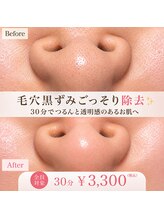 サロンドベル(salon de Belle)/毛穴美容液洗浄