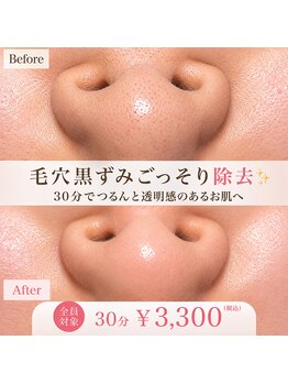 サロンドベル(salon de Belle)/毛穴美容液洗浄