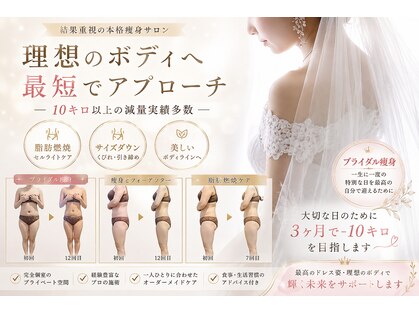 エステサロン ジュブリーの写真