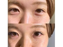 アイラッシュ オブ クリアー 一社店(eye lash OF clear)/バインドロック80本