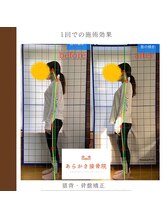 あらかき接骨院/【姿勢の変化】