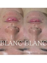 サロン ド ブラン アオヤマ(Salon de BLANC AOYAMA)/ニキビケア