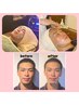 再来様【再び自分史上最高の小顔】　美容鍼×小顔矯正EMS　90分