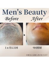 シャーロック(4869Sherlock)/髭BeforeAfter