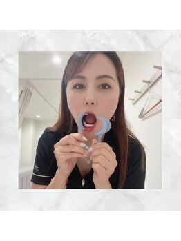 ホワイトニングショップ 下関店/オープナーで口元を固定します♪
