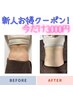 【新人スタッフ指名限定】　脂肪撃退 セレクト部位 ６０分