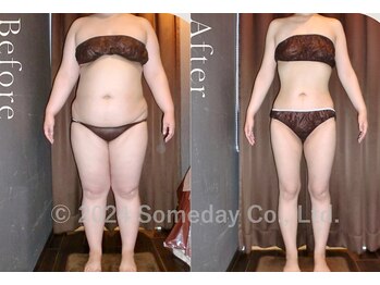 サムデイプレミアム 名駅店(SOMEDAY PREMIUM)/Before⇒Afterの変化