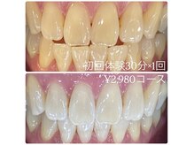 ホワイトニングルーム 横浜店(Whitening Room)/ホワイトニング/横浜