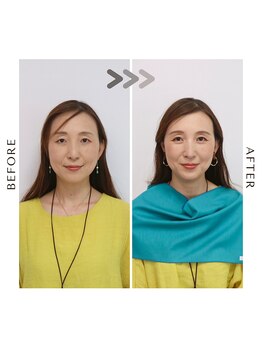 シュアリー(Surely)/トータルコースお客様事例