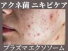 【再来】ニキビケア!プラズマシャワー+パック+エクソソーム¥11000→¥7700