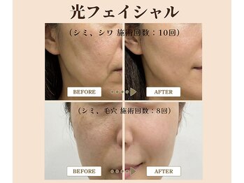 アフロディーテ(Aphrodite)/