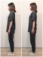 いとう美容整体/☆立ち姿勢横向きBefore After☆