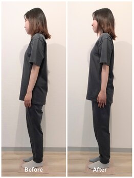 いとう美容整体/☆立ち姿勢横向きBefore After☆