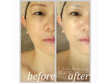 アン グレーヌ 自由が丘(unegraine)/瞳クッキリ！目尻は上向きに！