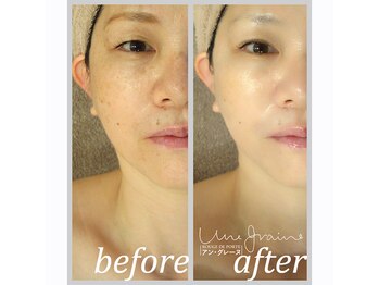 アン グレーヌ 自由が丘(unegraine)/瞳クッキリ！目尻は上向きに！