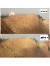 チアリー(Chiary)/マリムーブフェイシャルワックス