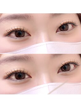 ソポ(sopo)/フラットラッシュ140本