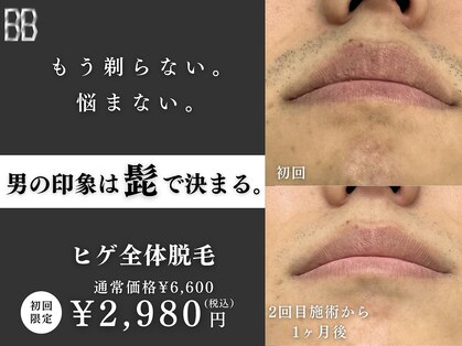 ビビ(BB)の写真