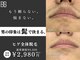 ビビ(BB)の写真