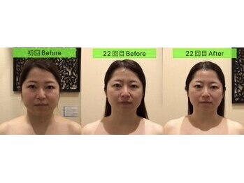 アジール 長岡リバーサイド千秋店(agir)/before/after画像