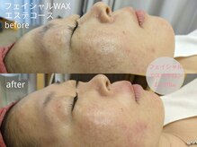 ラミーユ(La Miu)/WAXですっきり