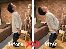 整体院プリュ/Before→ After［26］