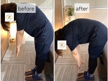 ゼン骨盤整体院(ZEN骨盤整体院)/【40代女性】腰痛