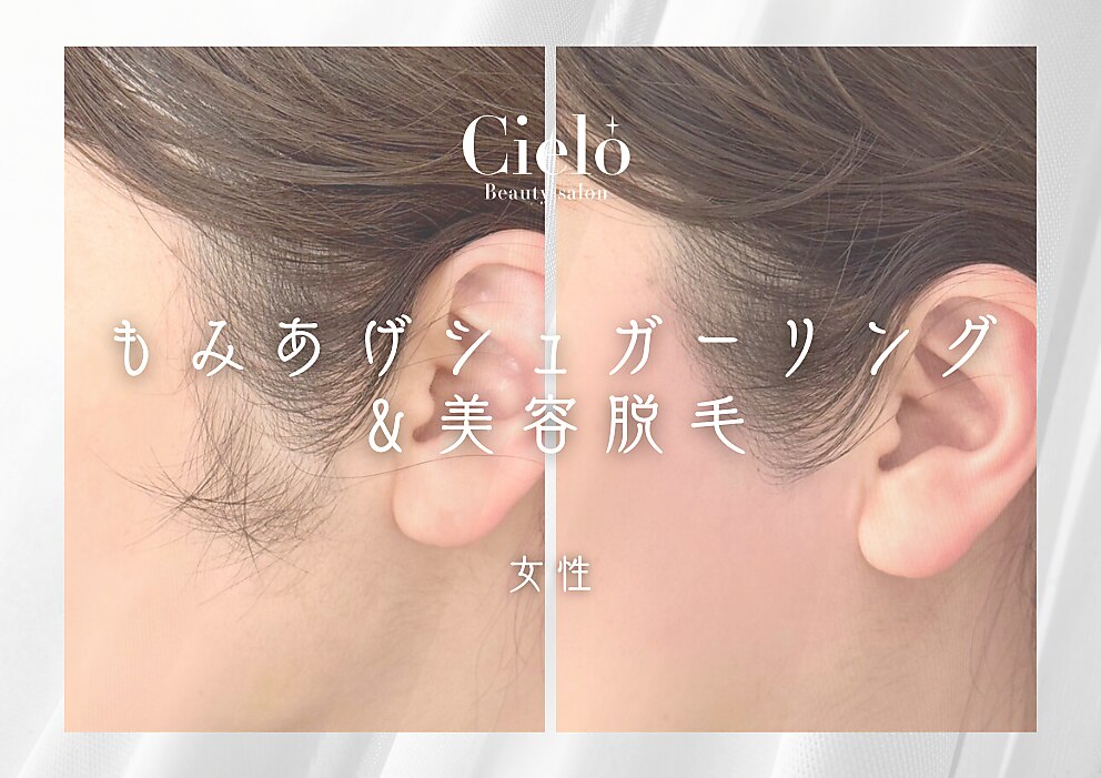 もみあげシュガーリング＆美容脱毛SET《横顔美人に》3,300円  