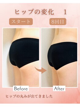 ラジュワード(lajward)/骨盤底筋トレーニング