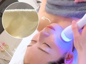 グレアージュ(GLEAGE)の写真/【流行りの艶肌ワックス×人気の水光イオン導入◆5,500円】で史上最高のメイクノリ/顔脱毛して美肌づくり♪