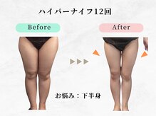 美容整体ウェリナ 中川八田院/小顔矯正/骨盤矯正/痩身整体