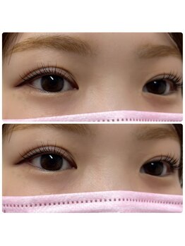 プラスアイ 赤羽東口店/ムーンロッド/担当：岩崎