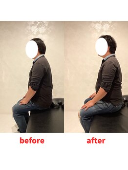 ナオル整体 福岡香椎院(NAORU整体)/40代男性施術事例【猫背】