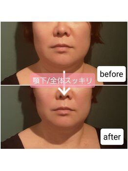 エルアンドエス(L&S)/むくみがスッキリ！