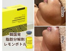 ラナ(LANA)/金沢唯一◎脂肪分解レモンボトル