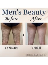 シャーロック(4869Sherlock)/脚BeforeAfter