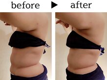 サロン ド ユキフラン(Salon de Yukifranc)/施術部位→ウエスト・お腹