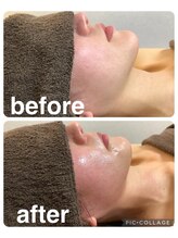 ギンザアール(GINZA R.)/小顔サロン◎