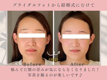 ソルビーフェイス(SOL*BeFace)/ブライダルフォト☆結婚式に