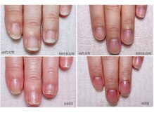 クリコネイル(kuriko nail)の雰囲気（ジェルを使わない自爪育成ただいまモニター募集中！縦長の美爪へ）