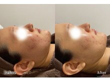 アネル 美里店(anel)/