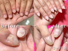 スマイル ネイル ラボラトリー(Smile nail laboratory)