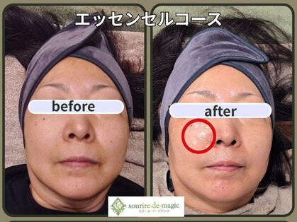 スリールドマジック(sourire de magic)の写真