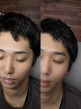 プラスアイビー 高松店(+i.b)/施術前カウンセリング