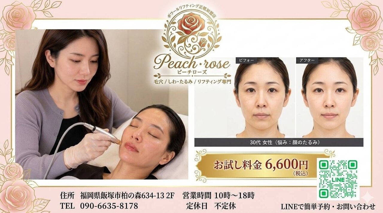 ピーチ ローズ(peach rose)｜ホットペッパービューティー