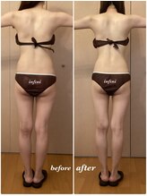 アンフィニ(infini)/短期集中コース5回目(1.5ヶ月）